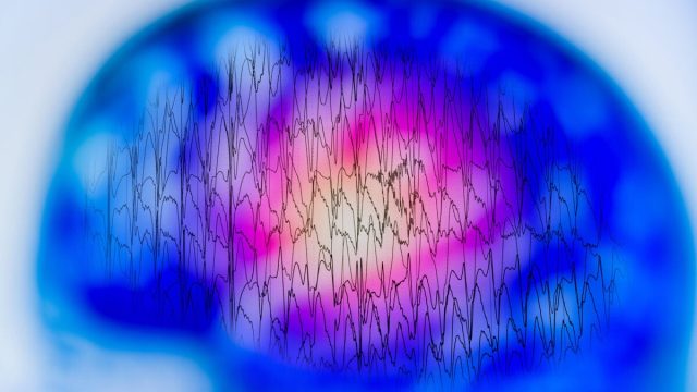 Sleep test may help diagnose and predict dementia in older adults