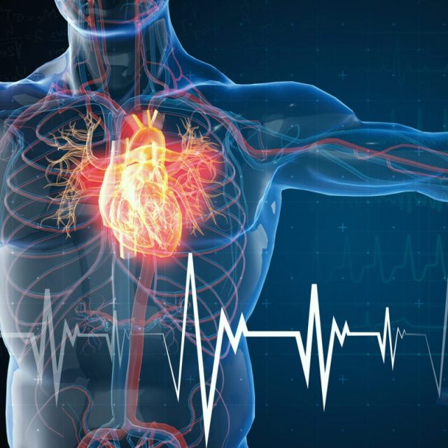 Uptick in heart attacks following 2016 presidential election